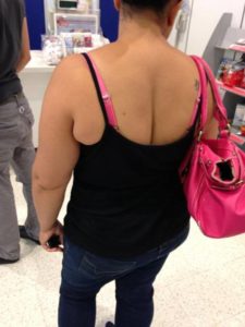  back cleavage