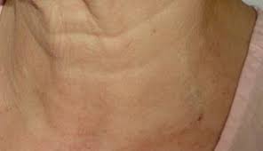 How To Make Your Neck Look Younger
