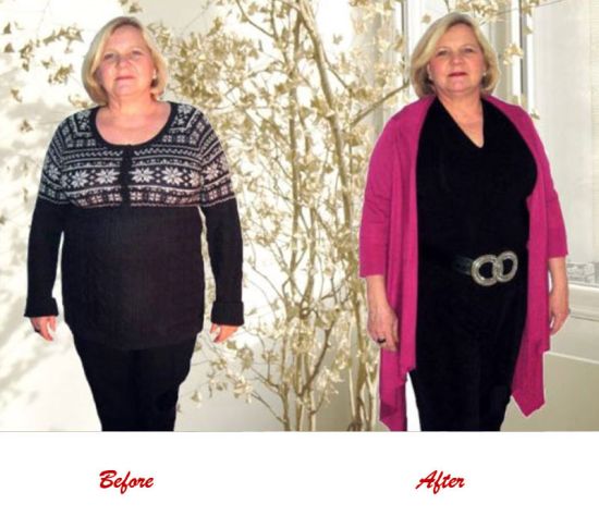 image styling before and after